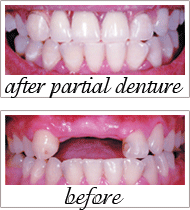 Pailin Dental patient