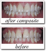 Pailin Dental patient