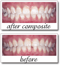 Pailin Dental patient