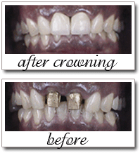 Pailin Dental patient