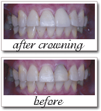Pailin Dental patient