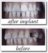 Pailin Dental patient