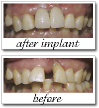 Pailin Dental patient