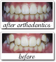 Pailin Dental patient