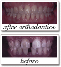 Pailin Dental patient