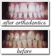 Pailin Dental patient