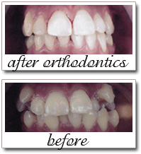 Pailin Dental patient