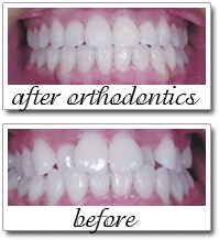 Pailin Dental patient