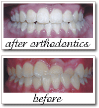 Pailin Dental patient