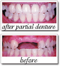 Pailin Dental patient
