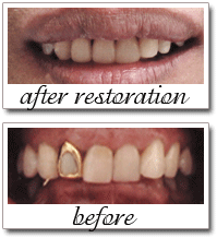 Pailin Dental patient