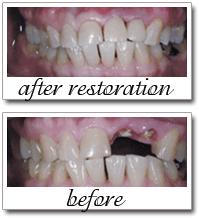 Pailin Dental patient