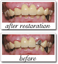 Pailin Dental patient